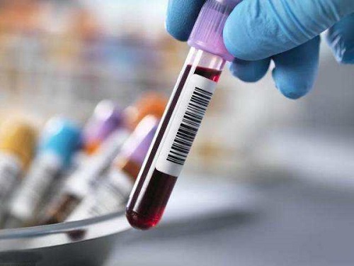 2021繼發性不孕能做試管嬰兒嗎？