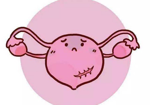 試管洗精術的費用是多少？促排方案怎么選？